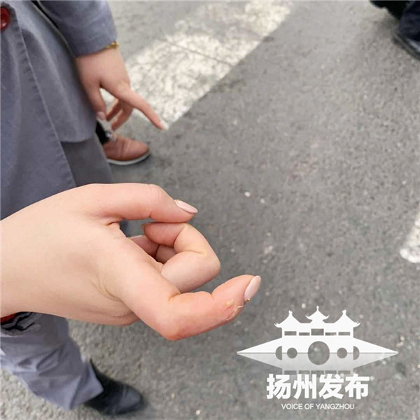 袁桂芳的手指被咬破