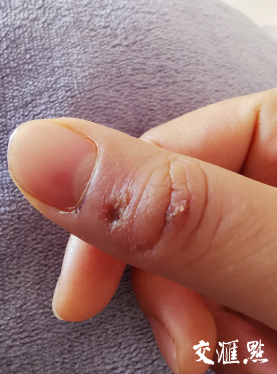 李莹莹,你救人的样子真美!