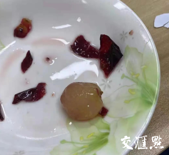 腹腔镜下剥皮成功的完整葡萄