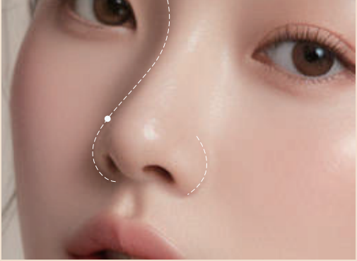 精湛技术领航风尚首尔丽格诠释鼻整形艺术