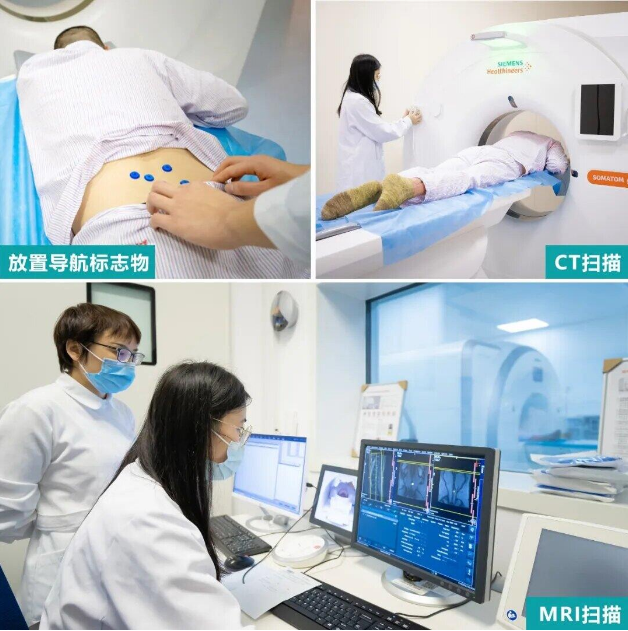 体位一致的俯卧位,腰背部手术区域粘贴导航标记(mark贴),进行腰骶椎ct