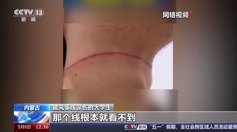 1714992123953791.png?x-oss-process=style/w10 image.png?x-oss-process=style/w10