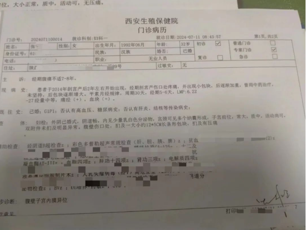 西安不孕不育医院科普:会"痛"的疤痕——腹壁子宫内膜异位症